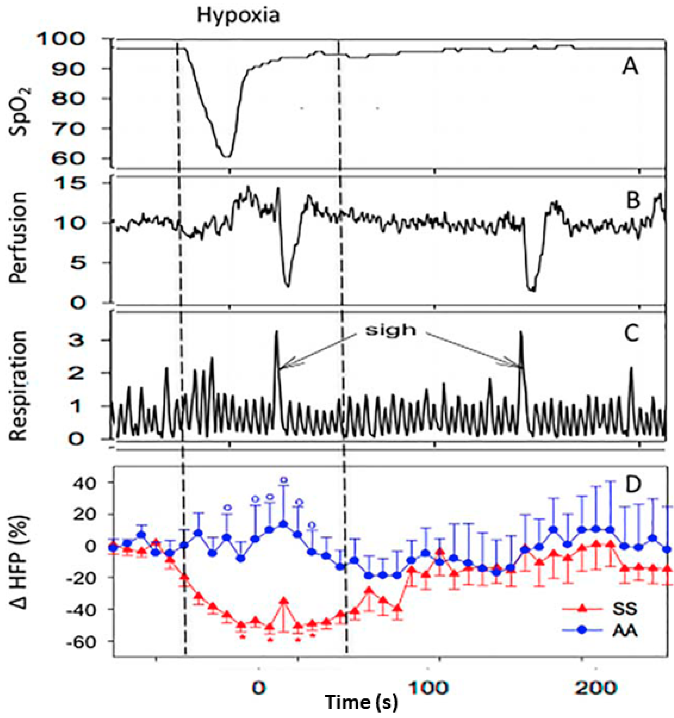 A graphical representation of acoustic sensing technology